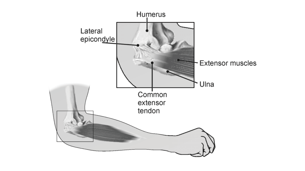 Muscle Function Analysis - Vernier