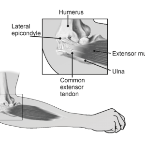 11.2 Movement - Vernier